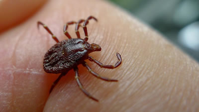 Lyme disease