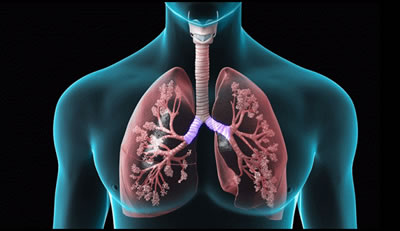 COPD, Pneumonia 