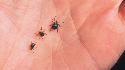 Tick and Lyme Disease Diagnosis and Treatment