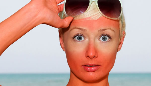 Summer Fun: Be Aware of Sunburns - ICD-10