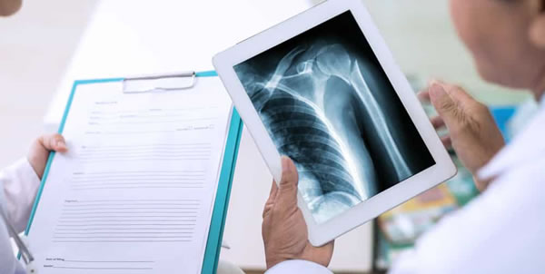 Are You Properly Reporting Radiology Services?