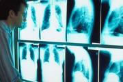 Diagnostic Radiology Claims, Denials, LCDs,  Medicare payer, Coding, CPT