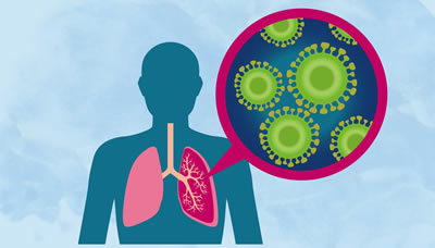 ICD-10 Codes, J18.1, J15.5, Lobar Pneumonia